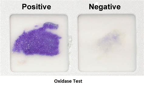 escherichia coli oxidase test|positive oxidase test result.